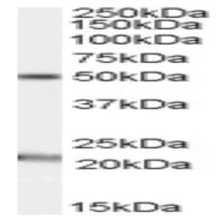 anti-Acylglycerol Kinase (AGK) (C-Term) antibody avatar