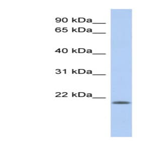 anti-ChaC, Cation Transport Regulator Homolog 2 (E. Coli) (CHAC2) (N-Term) antibody