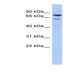 anti-Chromosome 1 Open Reading Frame 103 (C1orf103) (Middle Region) antibody avatar