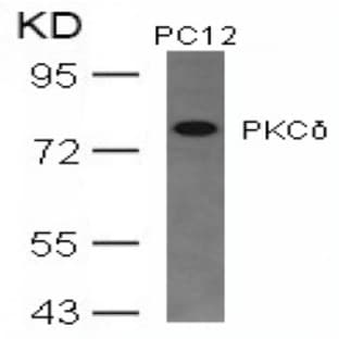 anti-Protein Kinase C, delta (PKCd) (AA 643-647) antibody avatar