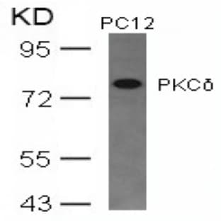anti-Protein Kinase C, delta (PKCd) (AA 643-647) antibody avatar