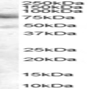 anti-DCP1 Decapping Enzyme Homolog A (S. Cerevisiae) (DCP1A) (C-Term) antibody avatar