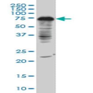 anti-DCP1 Decapping Enzyme Homolog A (S. Cerevisiae) (DCP1A) (AA 186-286) antibody avatar