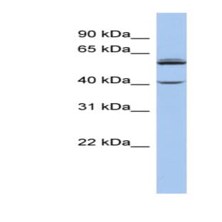 anti-Cytochrome P450, Family 4, Subfamily V, Polypeptide 2 (CYP4V2) (Middle Region) antibody avatar
