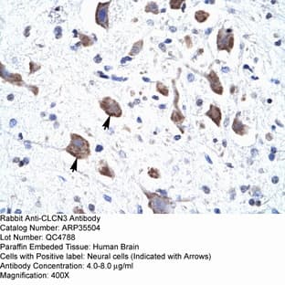 anti-Chloride Channel 3 (CLCN3) (C-Term) antibody avatar