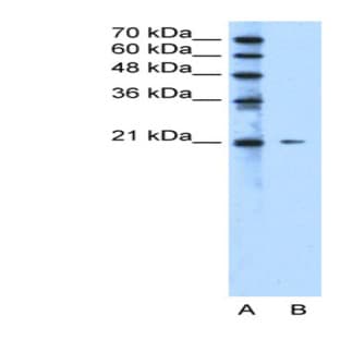 anti-Chromosome 20 Open Reading Frame 24 (C20ORF24) (N-Term) antibody avatar