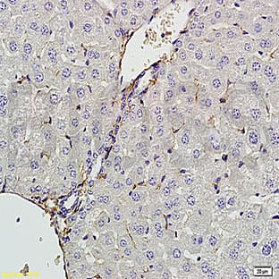 anti-Chemokine (C-X-C Motif) Ligand 13 (CXCL13) antibody avatar