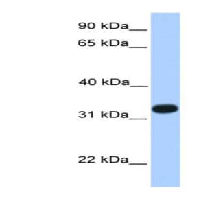 anti-Acrosomal Vesicle Protein 1 (ACRV1) (N-Term) antibody