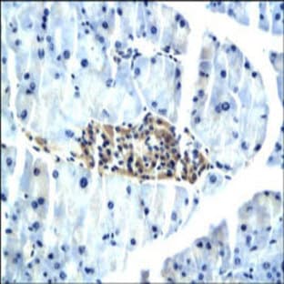 anti-Adiponectin Receptor 2 (ADIPOR2) (C-Term) antibody avatar