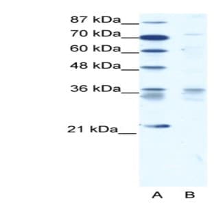 anti-BARX Homeobox 1 (BARX1) (Middle Region) antibody