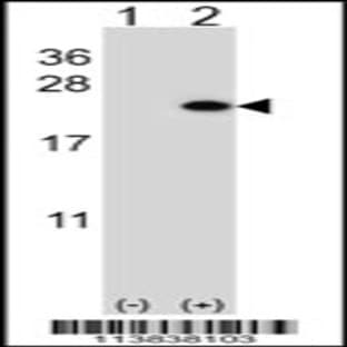 anti-BARX Homeobox 1 (BARX1) (C-Term), (AA 213-243) antibody