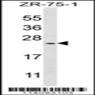 anti-BARX Homeobox 1 (BARX1) (AA 119-148), (Center) antibody avatar