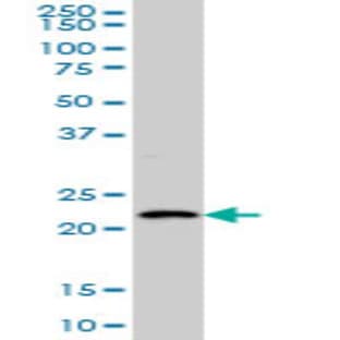 anti-BARX Homeobox 1 (BARX1) (AA 1-101) antibody