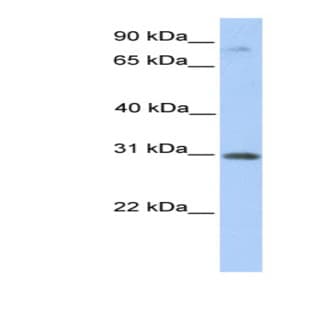 anti-Abhydrolase Domain Containing 13 (ABHD13) (C-Term) antibody avatar