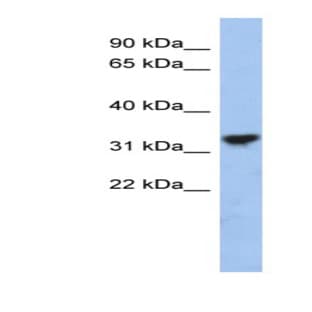 anti-Cytochrome C1 (CYC1) (Middle Region) antibody avatar