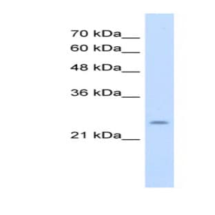 anti-Cysteine-Rich Hydrophobic Domain 1 (CHIC1) (N-Term) antibody avatar