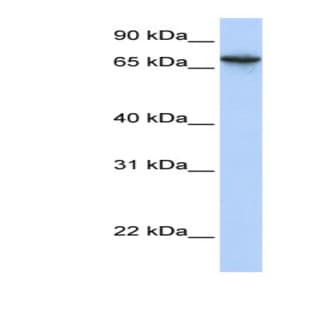 anti-Abhydrolase Domain Containing 16A (ABHD16A) (N-Term) antibody avatar