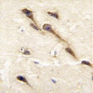 anti-Cytochrome P450, Family 26, Subfamily B, Polypeptide 1 (CYP26B1) (C-Term) antibody avatar