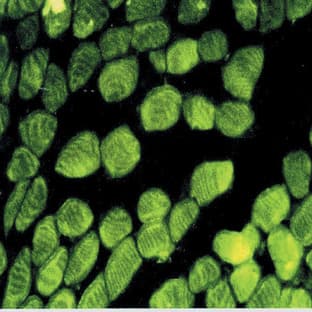 anti-Actin antibody avatar