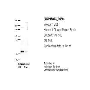 anti-Chromosome 21 Open Reading Frame 59 (C21orf59) (N-Term) antibody avatar