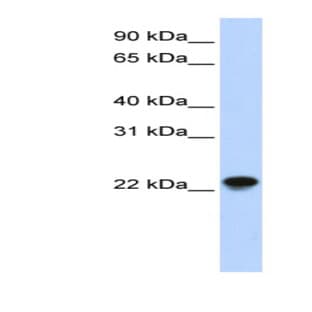anti-ADP-Ribosylation Factor-Like 8A (ARL8A) (Middle Region) antibody avatar