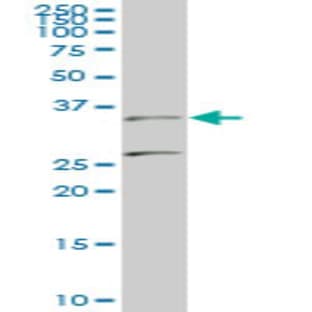 anti-BarH-Like Homeobox 1 (BARHL1) (AA 55-155) antibody avatar