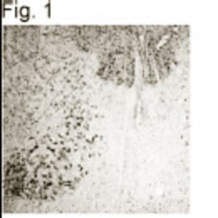 anti-Parkinson Protein 2, E3 Ubiquitin Protein Ligase (PARK2) (AA 298-313) antibody avatar