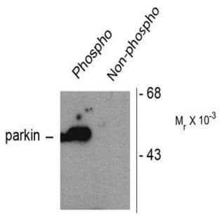 anti-Parkinson Protein 2, E3 Ubiquitin Protein Ligase (PARK2) (pSer101) antibody avatar