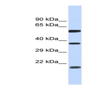 anti-5'-Nucleotidase Domain Containing 1 (NT5DC1) (N-Term) antibody avatar