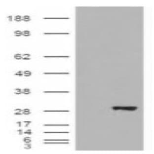 anti-3-hydroxybutyrate Dehydrogenase, Type 2 (BDH2) (Internal Region), (AA 60-71) antibody avatar