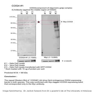 anti-Component of Oligomeric Golgi Complex 4 (COG4) (Middle Region) antibody avatar