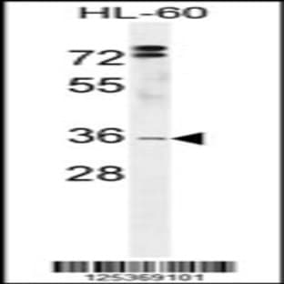 anti-Chromosome 3 Open Reading Frame 37 (C3ORF37) (C-Term), (AA 281-310) antibody avatar