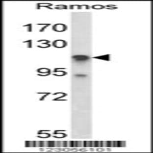 anti-Chromosome 11 Open Reading Frame 30 (C11orf30) (N-Term), (AA 46-75) antibody avatar