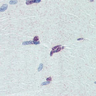 anti-PR Domain Containing 9 (PRDM9) (Middle Region) antibody avatar