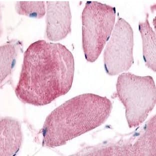 anti-Cyclin L1 (CCNL1) (Isoform 2) antibody avatar