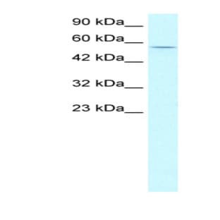 anti-Cyclin L1 (CCNL1) (N-Term) antibody avatar