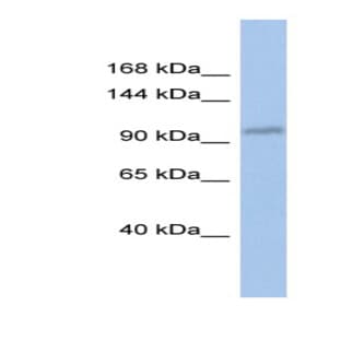 anti-DEAD (Asp-Glu-Ala-Asp) Box Polypeptide 24 (DDX24) (Middle Region) antibody avatar