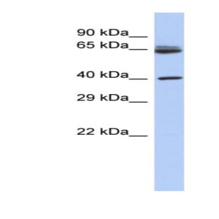 anti-Chimerin (Chimaerin) 2 (CHN2) (N-Term) antibody avatar