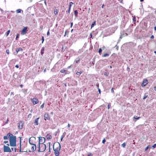 anti-Cysteinyl Leukotriene Receptor 2 (CYSLTR2) (Extracellular Domain) antibody avatar