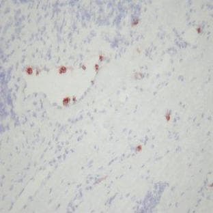 anti-CD177 Molecule (CD177) antibody avatar