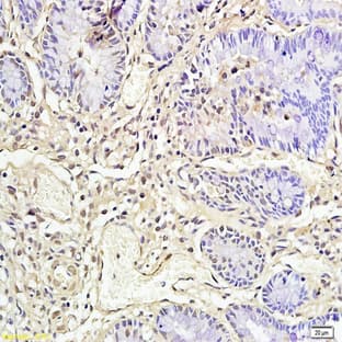 anti-CD177 Molecule (CD177) antibody avatar
