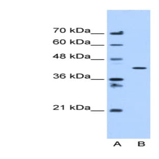 anti-Adipocyte Plasma Membrane Associated Protein (APMAP) (C-Term) antibody avatar