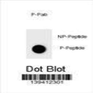 anti-BCL2-Associated Agonist of Cell Death (BAD) (pSer124) antibody avatar