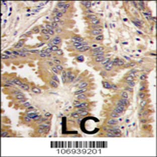 anti-BCL2-Associated Agonist of Cell Death (BAD) (AA 53-81), (Center) antibody avatar