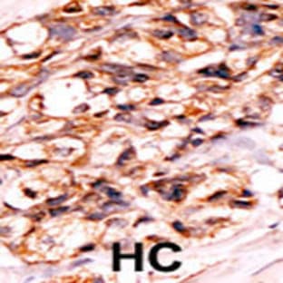 anti-BCL2-Associated Agonist of Cell Death (BAD) (pSer118) antibody avatar