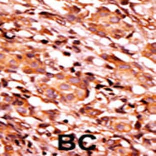 anti-BCL2-Associated Agonist of Cell Death (BAD) (pSer134) antibody avatar