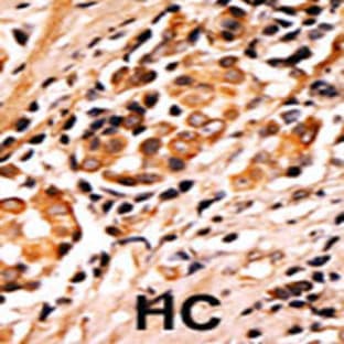 anti-BCL2-Associated Agonist of Cell Death (BAD) (pSer75) antibody avatar