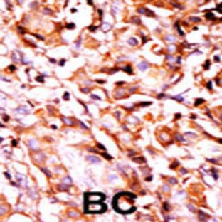 anti-BCL2-Associated Agonist of Cell Death (BAD) (pSer99) antibody avatar