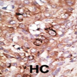 anti-BCL2-Associated Agonist of Cell Death (BAD) (AA 92-127), (BH3 Domain) antibody avatar