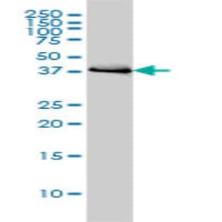 anti-BCL2-Associated Athanogene (BAG1) (AA 241-346) antibody avatar